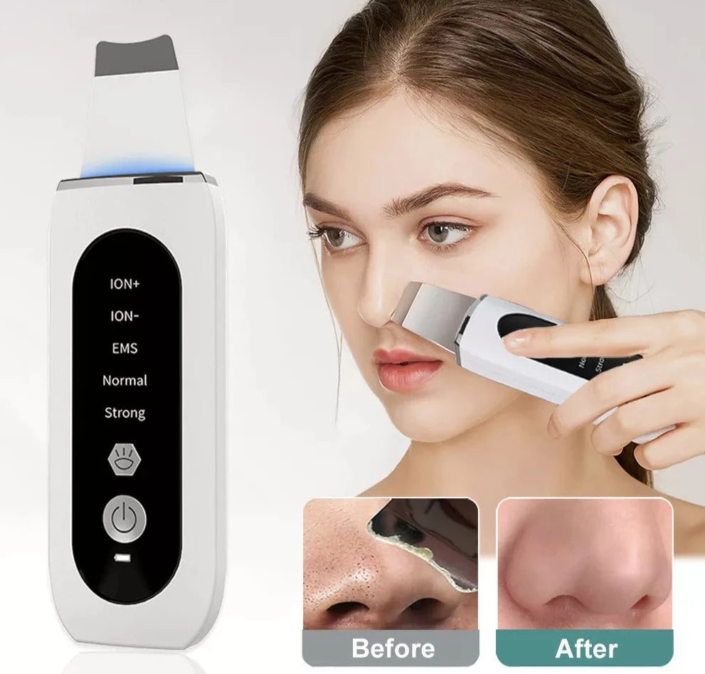 Face Deep Blackhead Remover